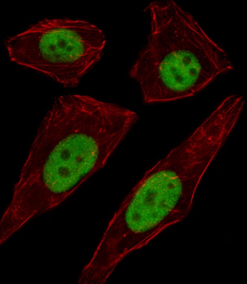 TFAP2D Antibody