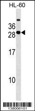 STXBP6 Antibody