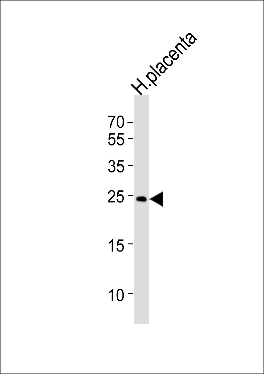 ANP32B Antibody