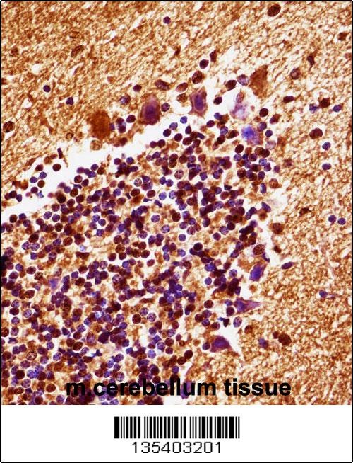 Mouse Map2k4 Antibody