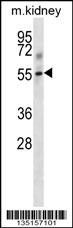 Mouse Tgfbr1 Antibody