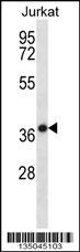 HSPBP1 Antibody