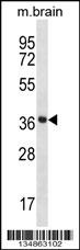Mouse Prkaca/Prkacb Antibody