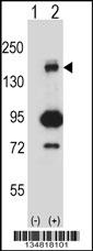 Mouse Map3k5 Antibody