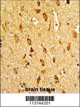 H Cadherin Antibody