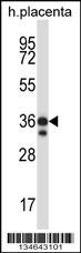 Mouse Mst4 Antibody
