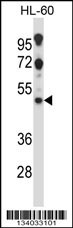 HTR2C Antibody