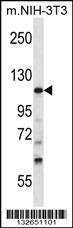 TUBGCP5 Antibody