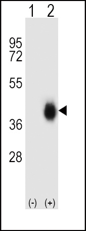 FCAR Antibody