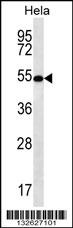 SCHIP1 Antibody