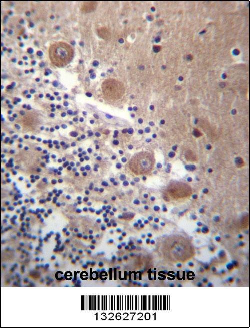 SCHIP1 Antibody