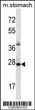 ALKBH4 Antibody
