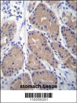 CA1 Antibody