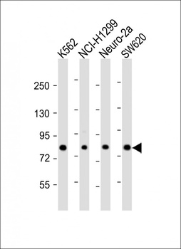 MLXIPL Antibody