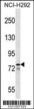 MLXIPL Antibody