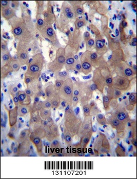 MLXIPL Antibody