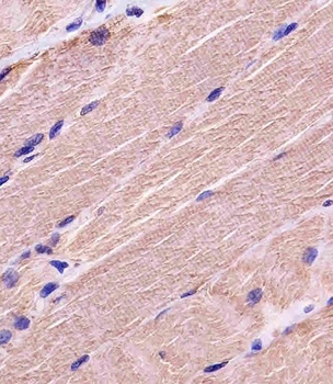 MYBPC3 Antibody