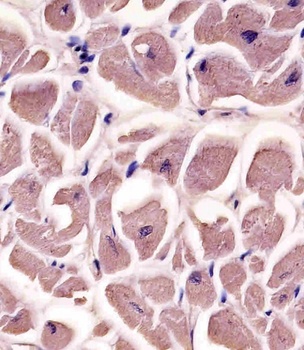MYBPC3 Antibody