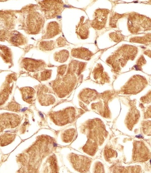 MYBPC3 Antibody