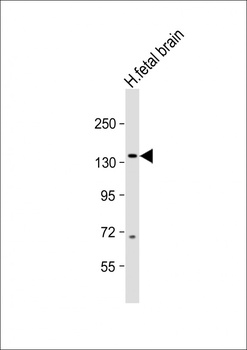 MAP3K15 Antibody
