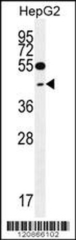 TXNL2 Antibody