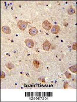 FUSSEL18 Antibody
