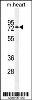 OTOP1 Antibody