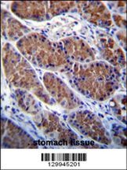OTOP1 Antibody