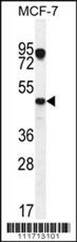 VEGF3 Antibody