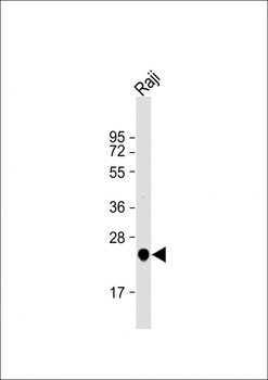 UQCRFS1 Antibody