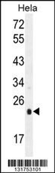 UQCRFS1 Antibody