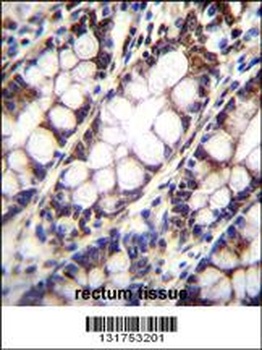 UQCRFS1 Antibody