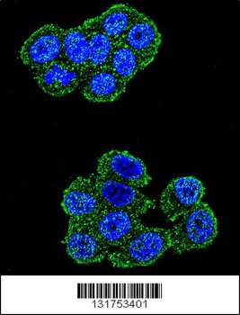 UQCRFS1 Antibody