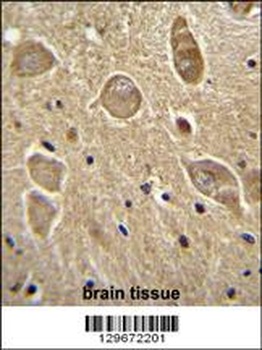 UGT8 antibody