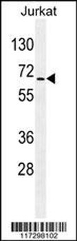 RBM14 Antibody