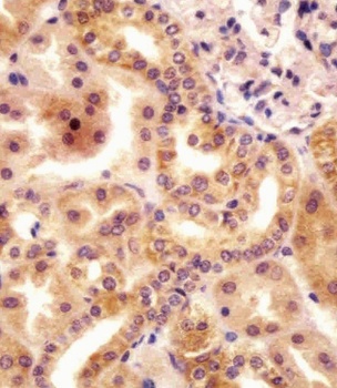 RSBN1 Antibody