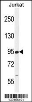 RSBN1 Antibody