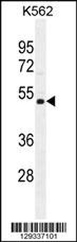NUDT19 Antibody