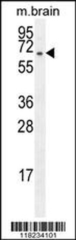FBXO21 Antibody
