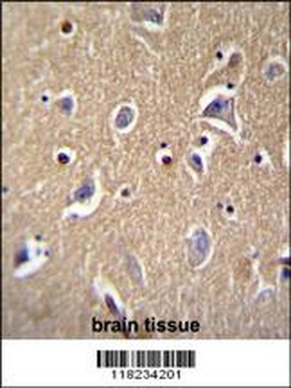 FBXO21 Antibody