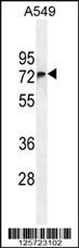 FBXO24 Antibody