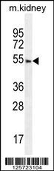 FBXO24 Antibody
