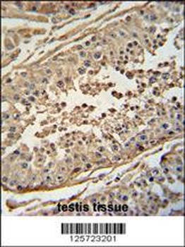 FBXO24 Antibody