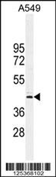 CT112 Antibody