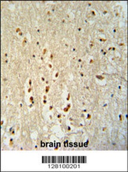 PTOV1 Antibody