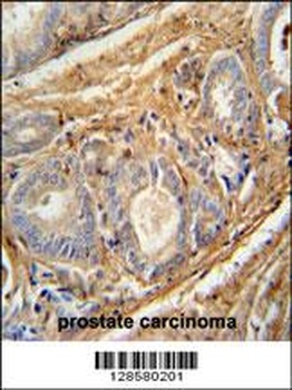 PCOTH Antibody