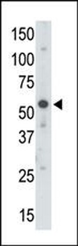 UBE1C Antibody