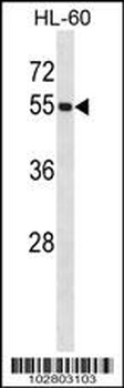 UBE1C Antibody