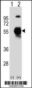 UBE1C Antibody