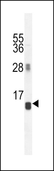 AVPI1 Antibody